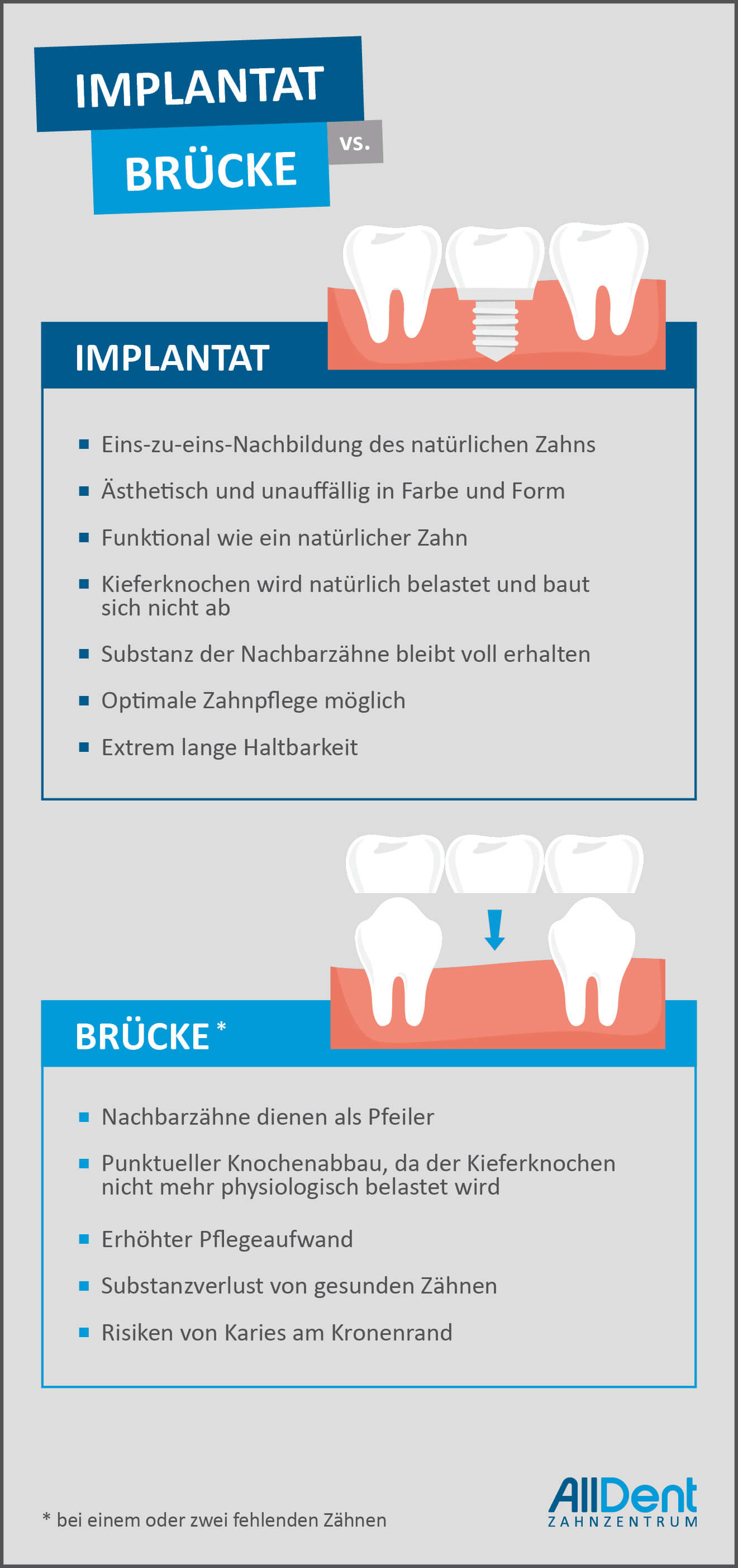 Zahnimplantate oder Brücke - der Vergleich